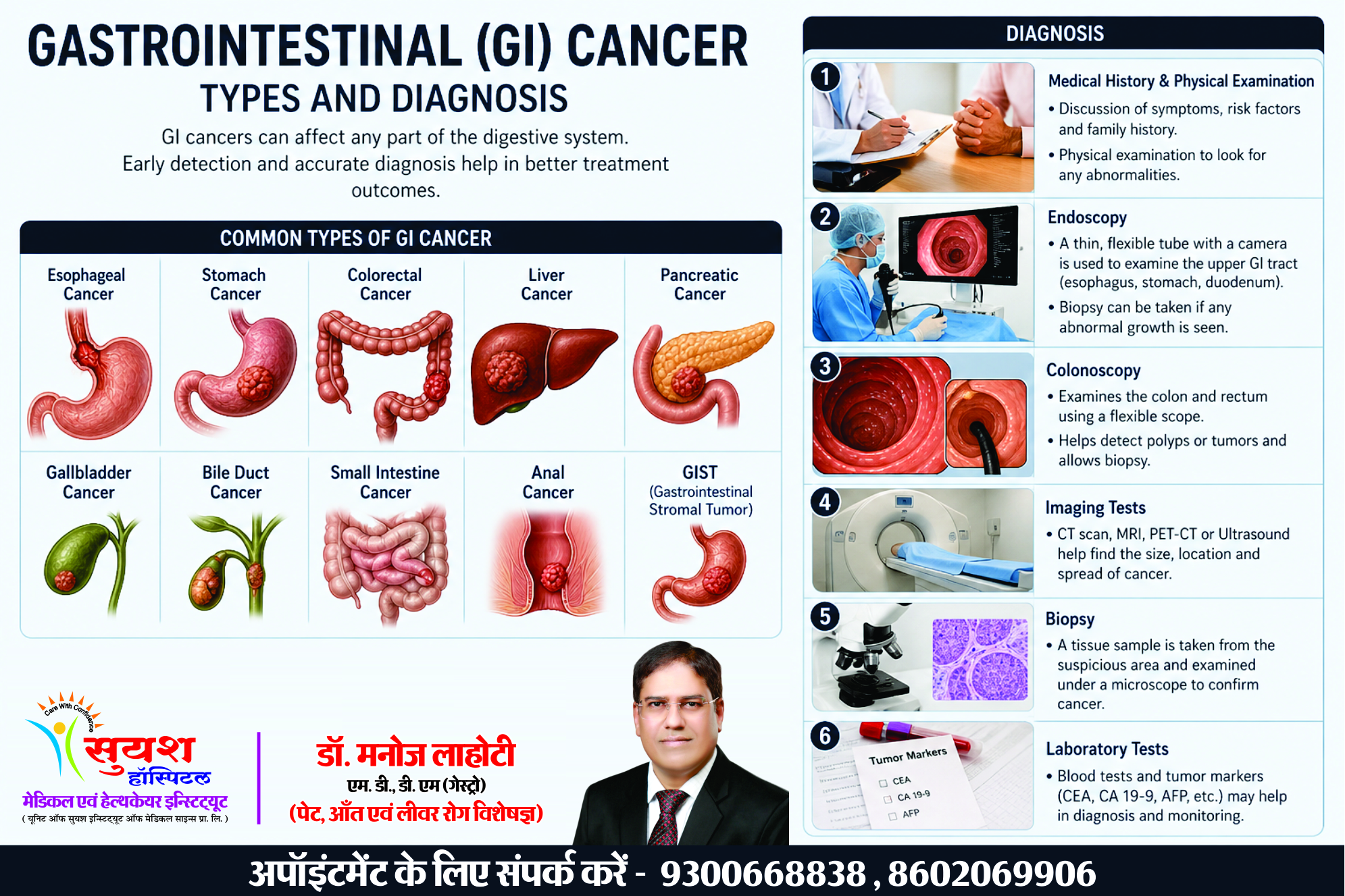 GI Cancer